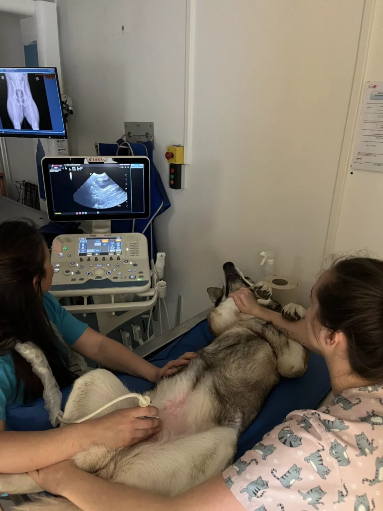 échographie abdominale