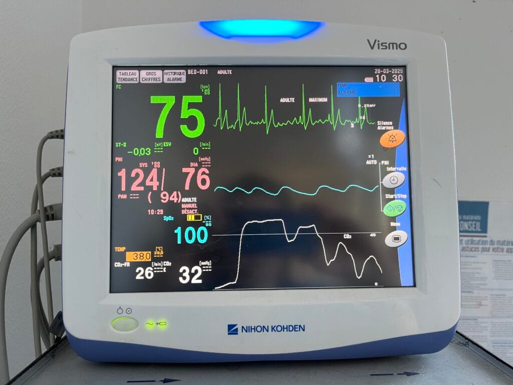 monitoring anesthésique